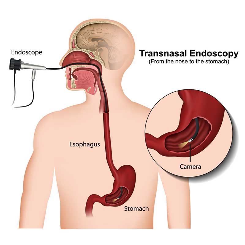 Endoscopy Bhandari Hospital Research Centre